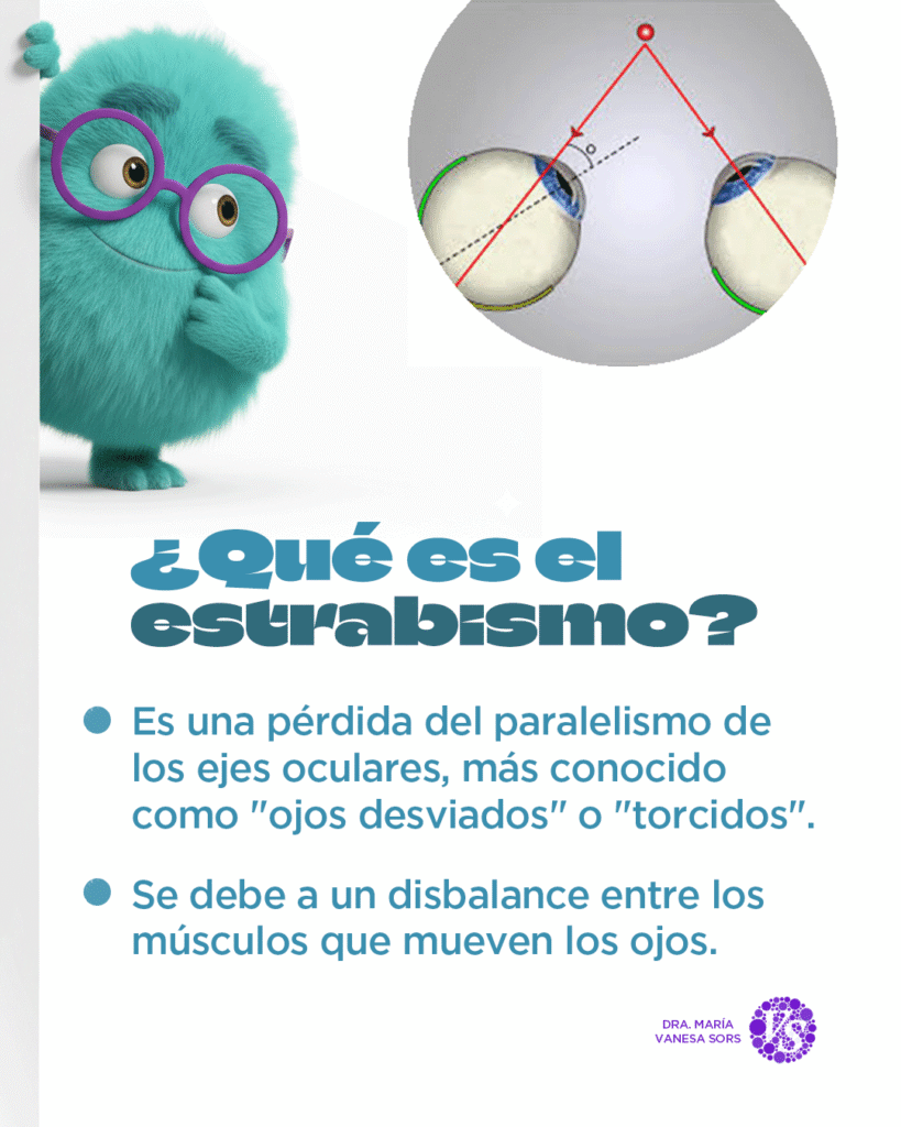 carrusel-estrabismo_02
